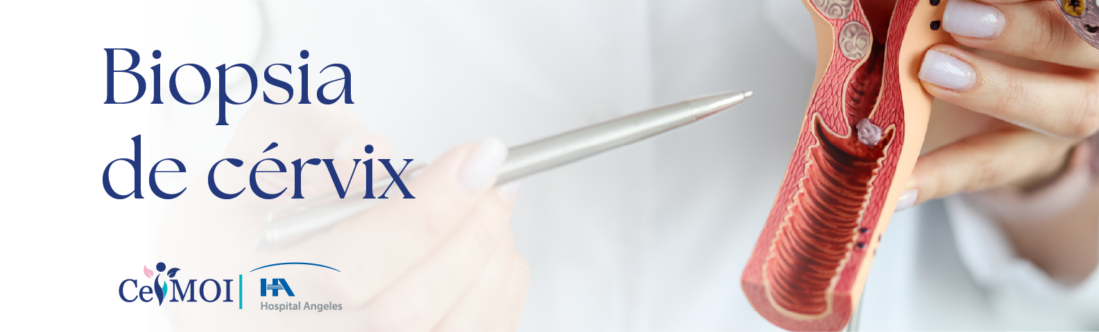 Biopsia de Cérvix