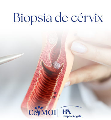 Biopsia de Cérvix