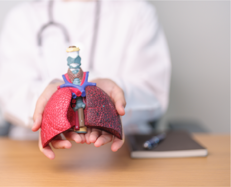 Lobectomía pulmonar